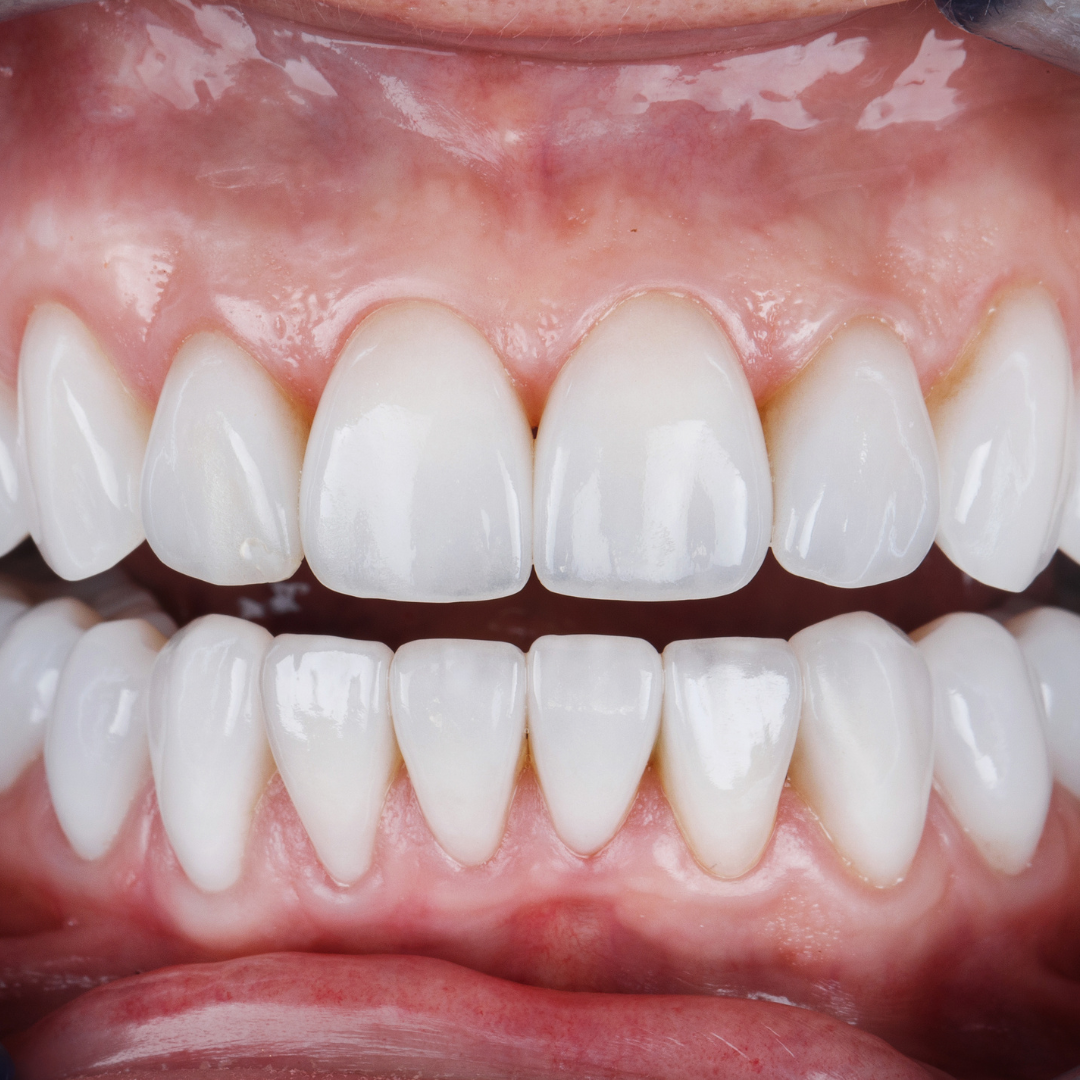 dentique-dental-studio-cosmetic-dentistr